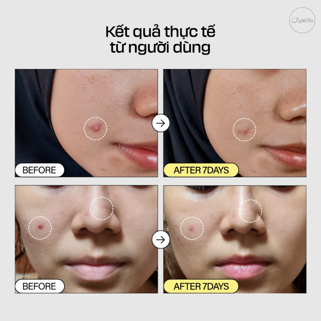 Tinh chất dưỡng da Ốc sên JUMISO Snail Mucin 95 + Peptide 140ml