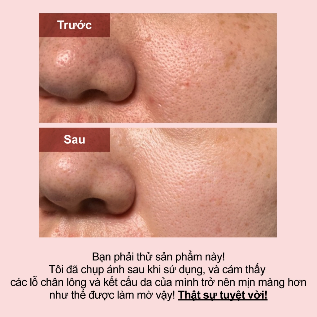 Mặt nạ trắng da numbuzin tiêu nhỏ lỗ chân lông số 3