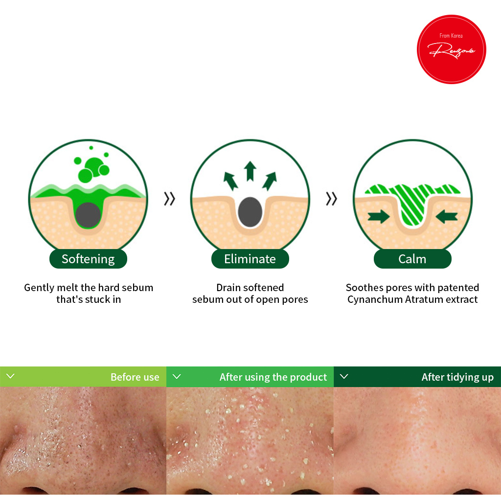 Naturekind - Chất Tan Chảy Đầu Đen 50mL