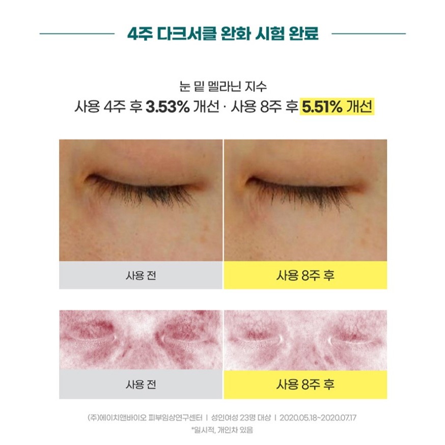 Kem / Kem Dưỡng Nâng Tông Màu Da Loại Bỏ Quầng Thâm / Nếp Nhăn Hiệu Quả goodal