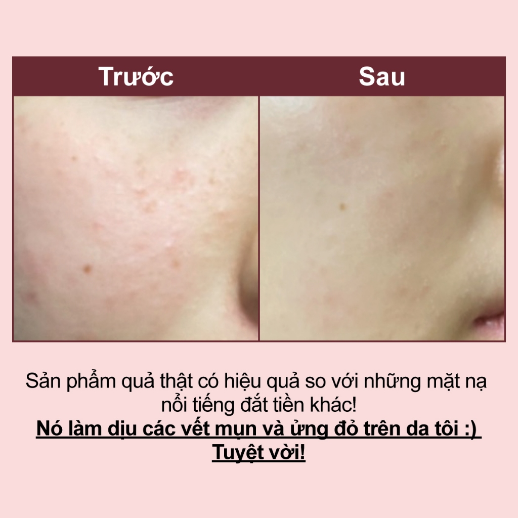 Mặt nạ trắng da numbuzin tiêu nhỏ lỗ chân lông số 3