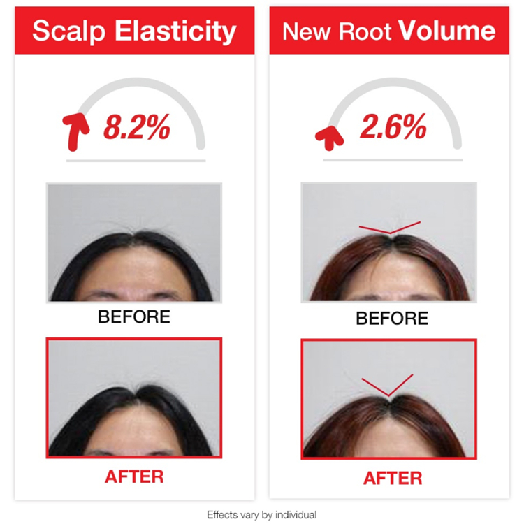 Dầu Gội Đầu Foligen plus Dr.Borhair 70ml