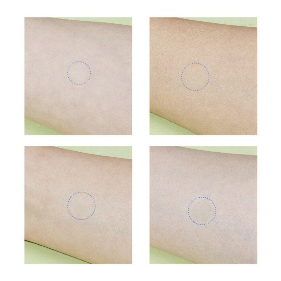 Miếng dán xẹp mụn tàng hình Dongkook Madeca