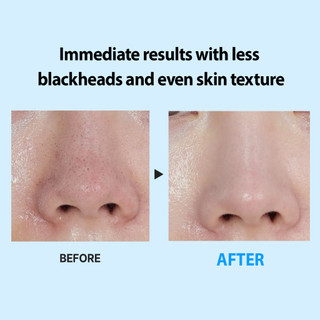 MEDIPEEL Extra Super 9 Plus Active Stick 33g