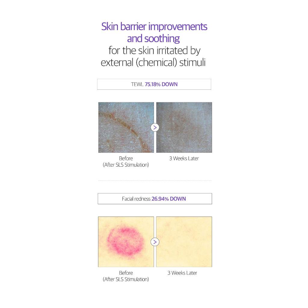 Kem Phục Hồi Làm Mịn Da dermafirm r4 50ml