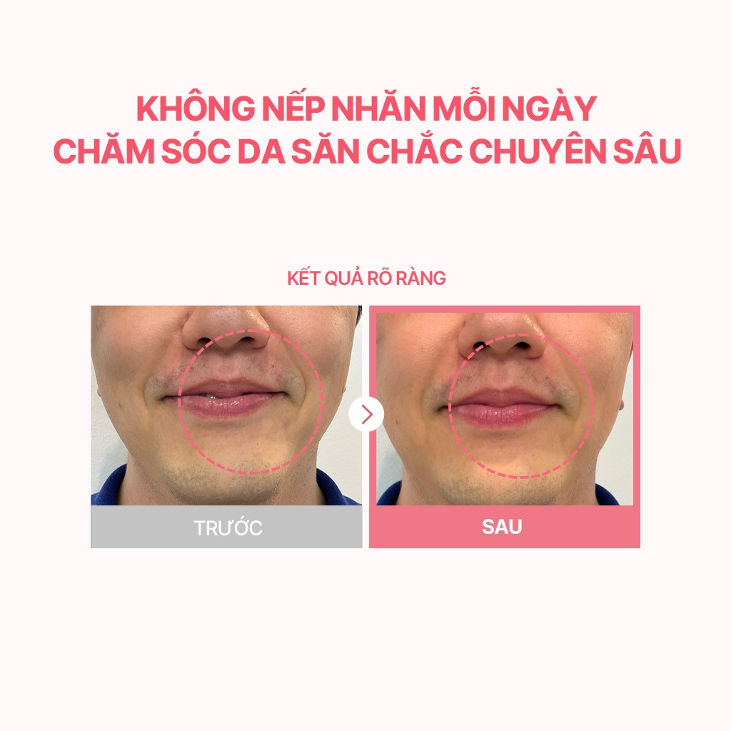 Kem săn chắc da TORRIDEN Cellmazing 5D Collagen 60ml se khít lỗ chân lông chăm sóc đàn hồi chống nếp nhăn