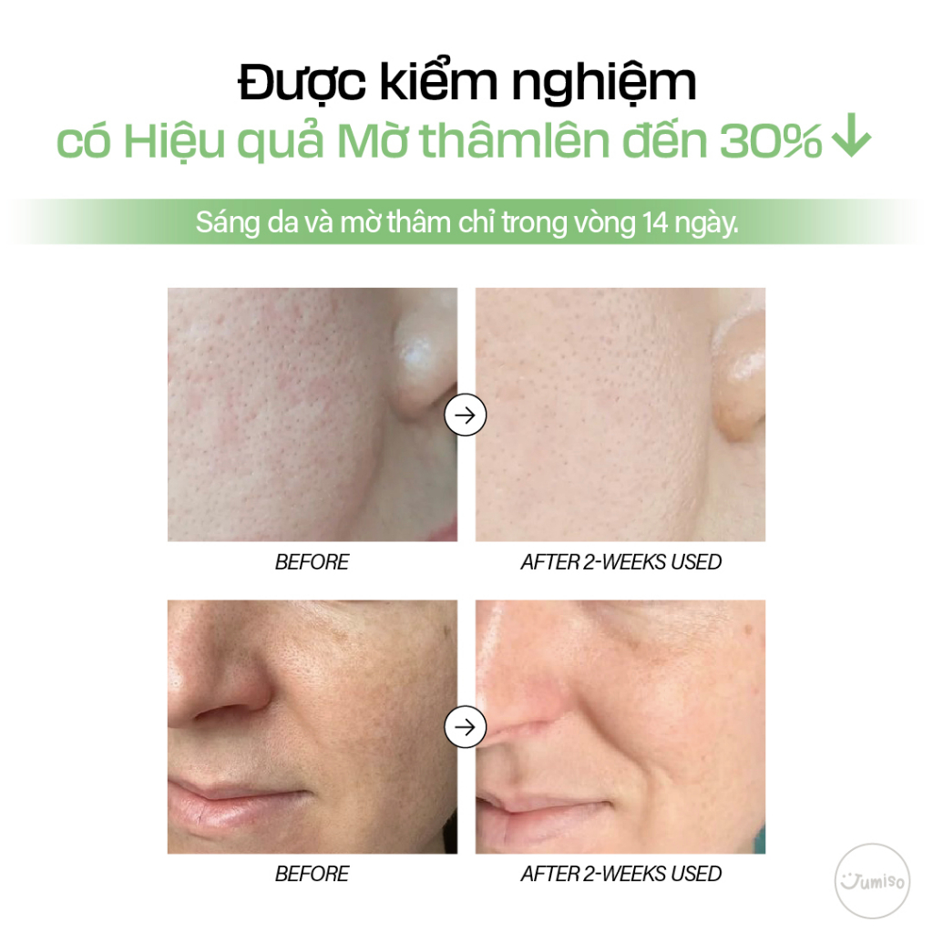 Serum làm mờ thâm Jumiso All Day Vitamin Pure C 5.5 30ml