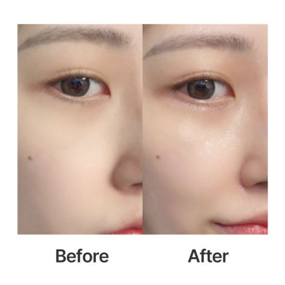 Máy tạo sóng siêu âm Labelle l7