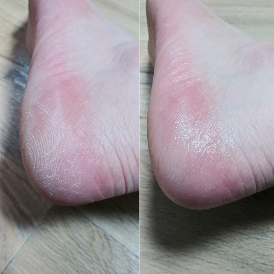 Sáp lăn dưỡng da chân mềm mại Auau BodleFoot Stick 18g