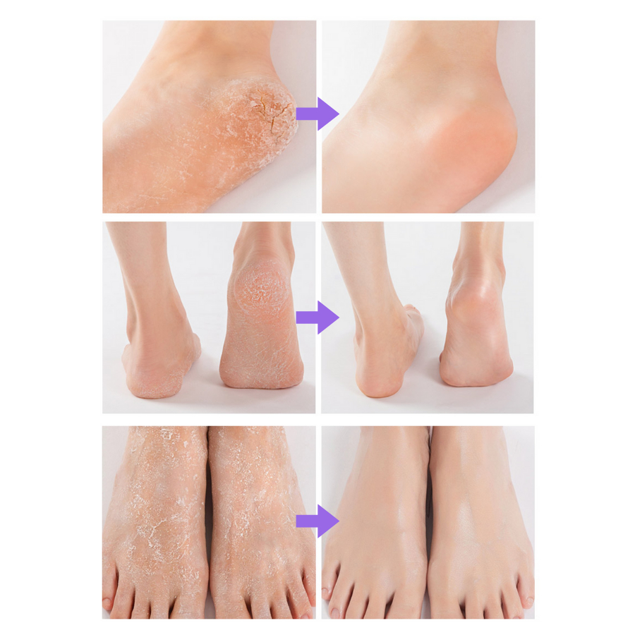 Sáp lăn dưỡng da chân mềm mại Auau BodleFoot Stick 18g