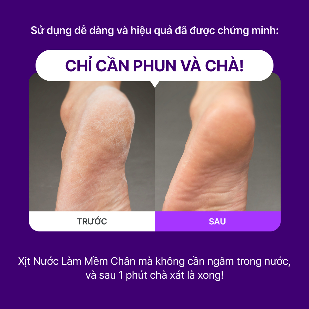 baren Công Cụ Loại Bỏ Vết Chai Bộ dụng cụ cho bàn chân