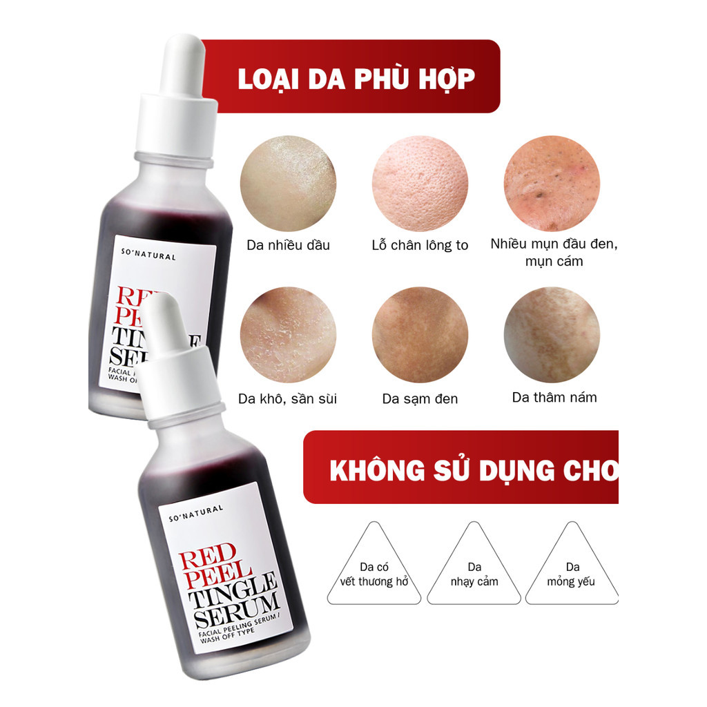 [35ML] Serum Tinh Chất Red Peel So Natural - Peel Da Lành Tính, Đào Thải Tế Bào Chết & Làm Sáng, Không Bong tr.ó.c | BigBuy360 - bigbuy360.vn
