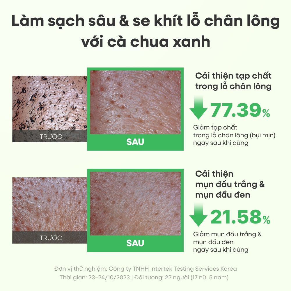 [FULLY Chính hãng] COMBO Sữa rửa mặt kiêm mặt nạ đất sét cà chua xanh 120ml + Brush làm sạch lỗ chân lông | BigBuy360 - bigbuy360.vn