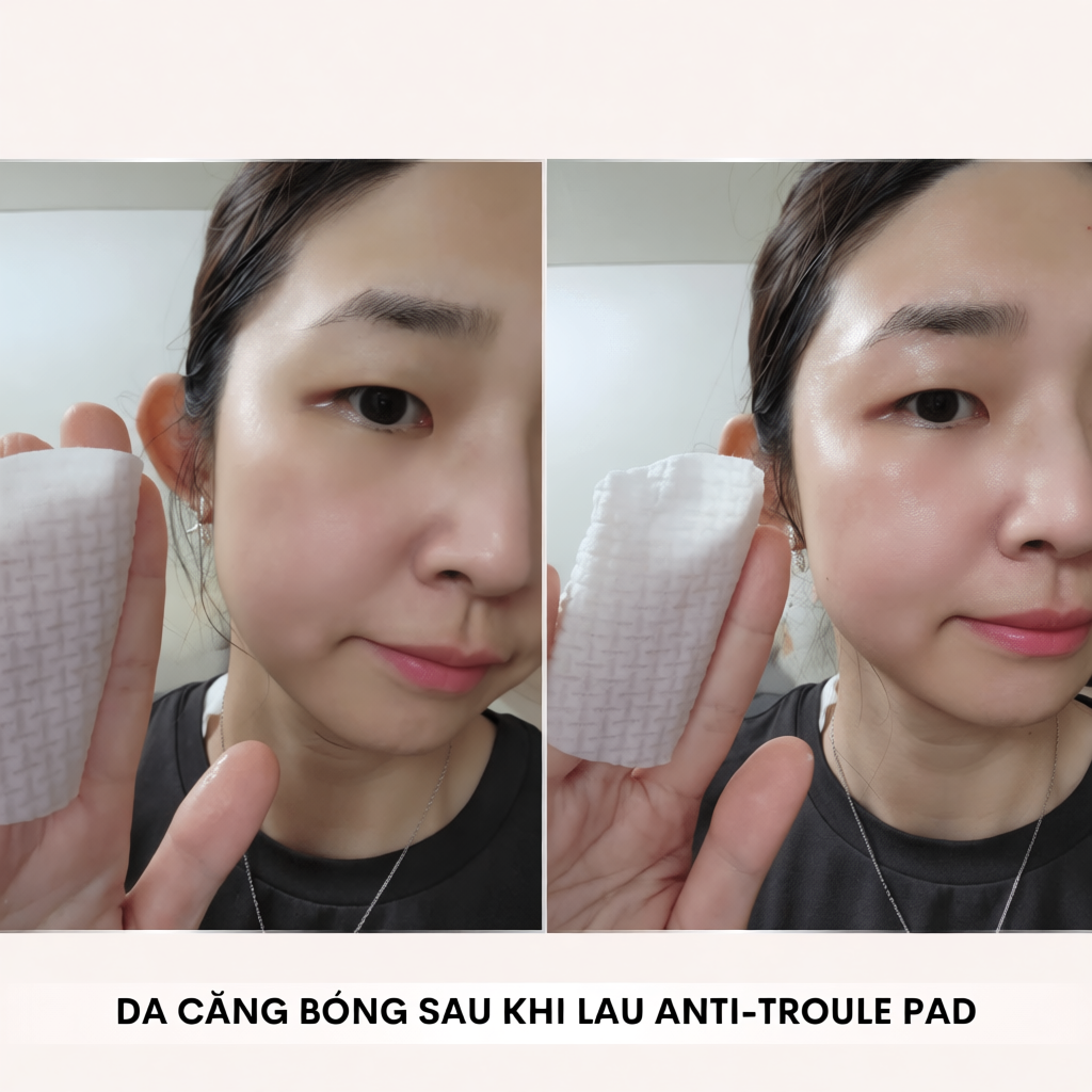 Toner Pad Needly Anti-Trouble Làm Sạch Bã Nhờn Căng Bóng 250G 60 Miếng