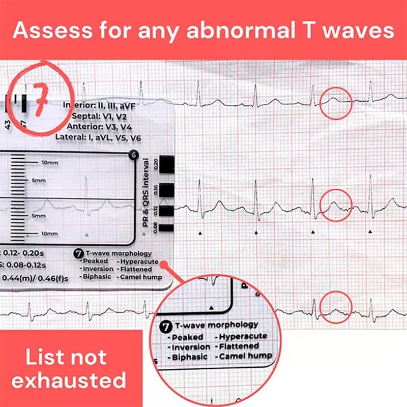 2 Thước đo bước ECG 7 bước, Thước đo bước ECG 7 bước để giải thích ECG / EKG, Thước đo ECG, Công cụ 