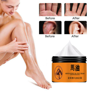 Crack Kem chống nứt gót chân Kem sửa chữa vết nứt Sửa chữa bàn tay và bàn chân crema acaladora de piel crema para estrias