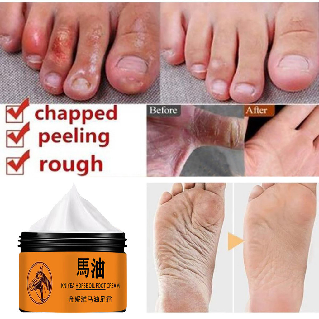 Crack Kem chống nứt gót chân Kem sửa chữa vết nứt Sửa chữa bàn tay và bàn chân crema acaladora de piel crema para estrias