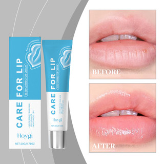  Kem dưỡng môi Fade Spots, dưỡng ẩm cho môi thâm, 20g
