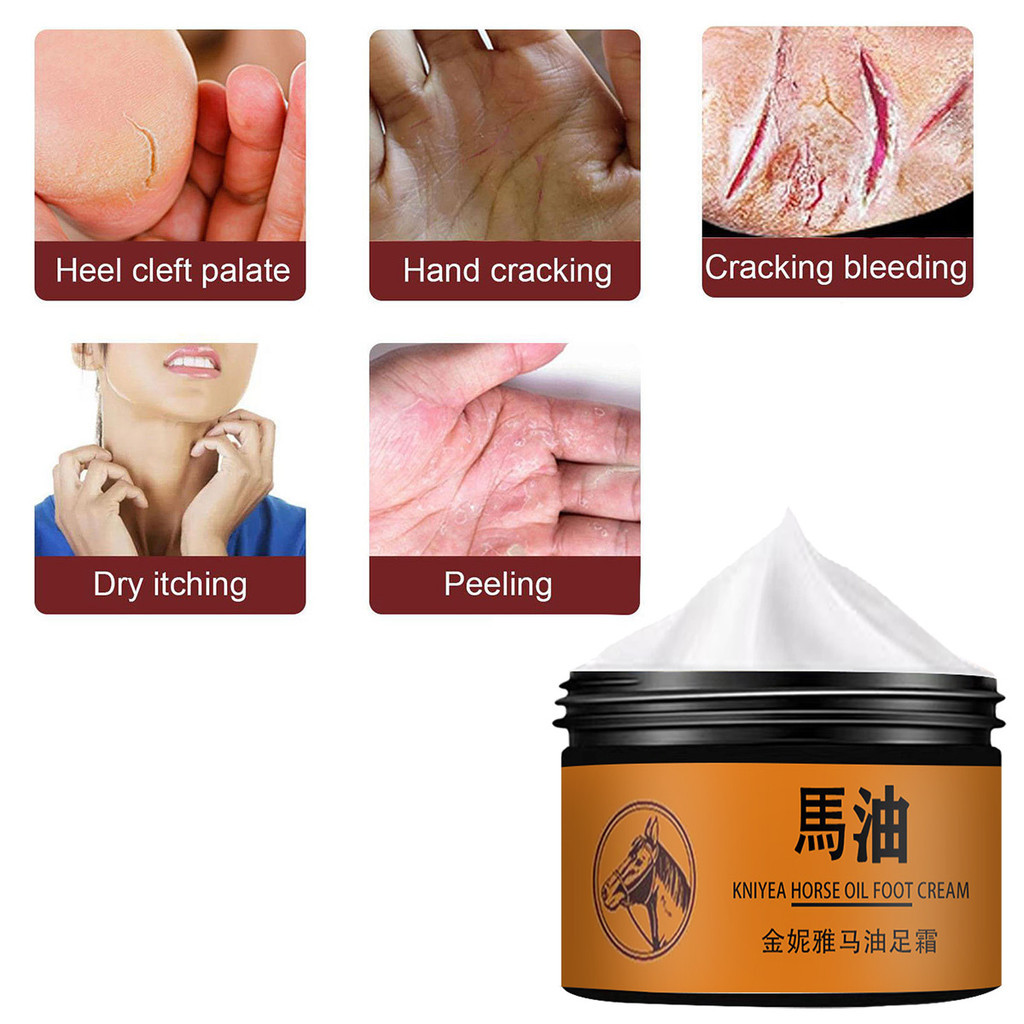 Crack Kem chống nứt gót chân Kem sửa chữa vết nứt Sửa chữa bàn tay và bàn chân crema acaladora de piel crema para estrias
