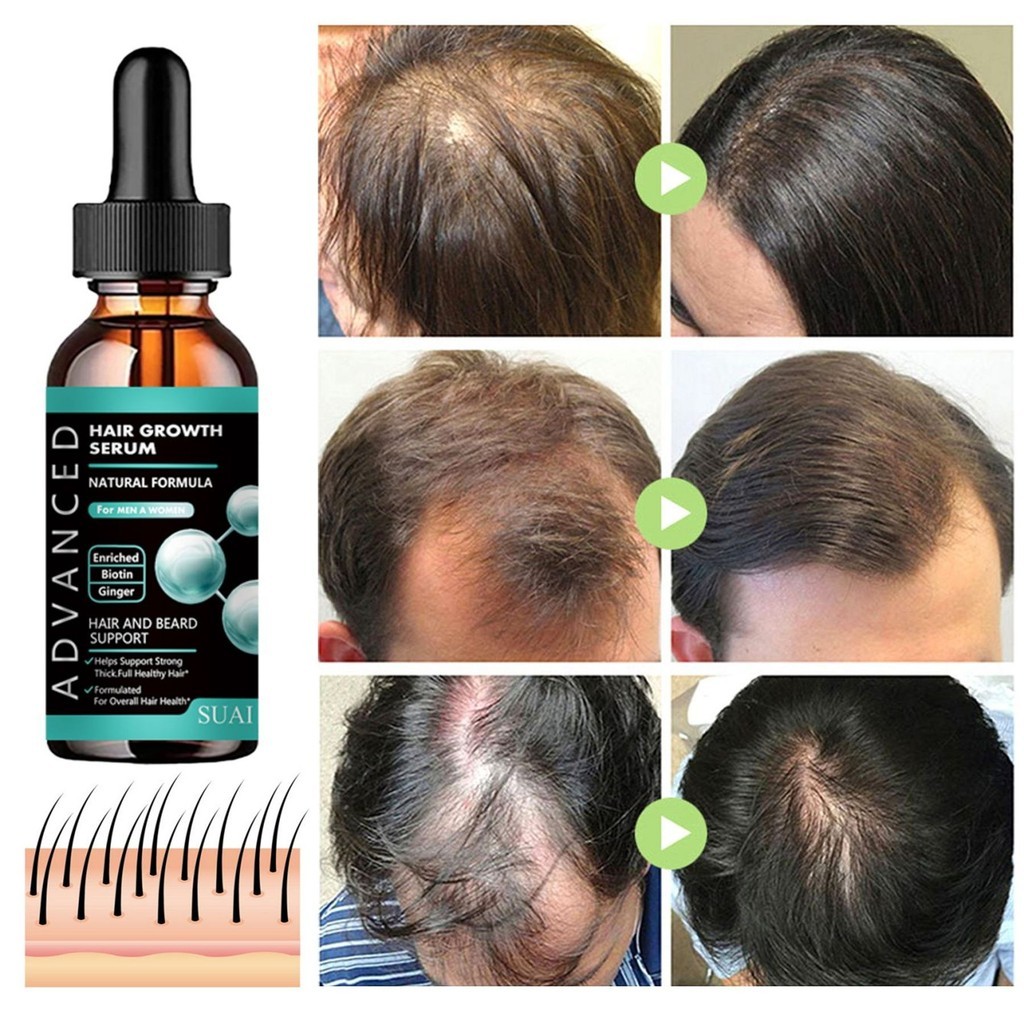 Dầu râu mọc tóc râu mọc tóc để mọc tóc nhanh