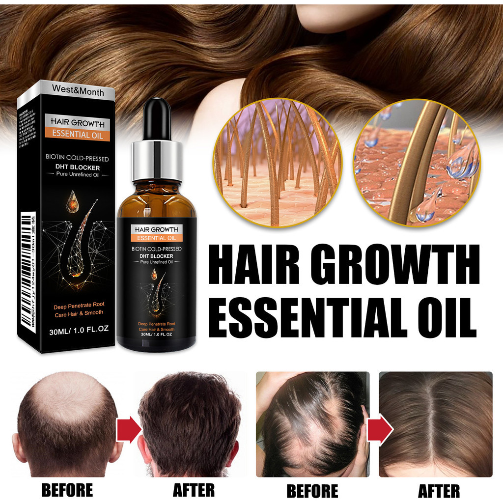 Tinh Dầu Hữu Cơ 30ml Mát Xa Kích Thích Mọc Tóc Chống Rụng Tóc