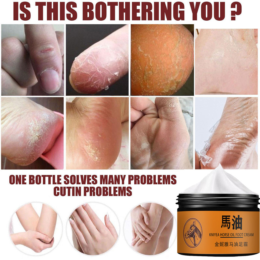 Crack Kem chống nứt gót chân Kem sửa chữa vết nứt Sửa chữa bàn tay và bàn chân crema acaladora de piel crema para estrias