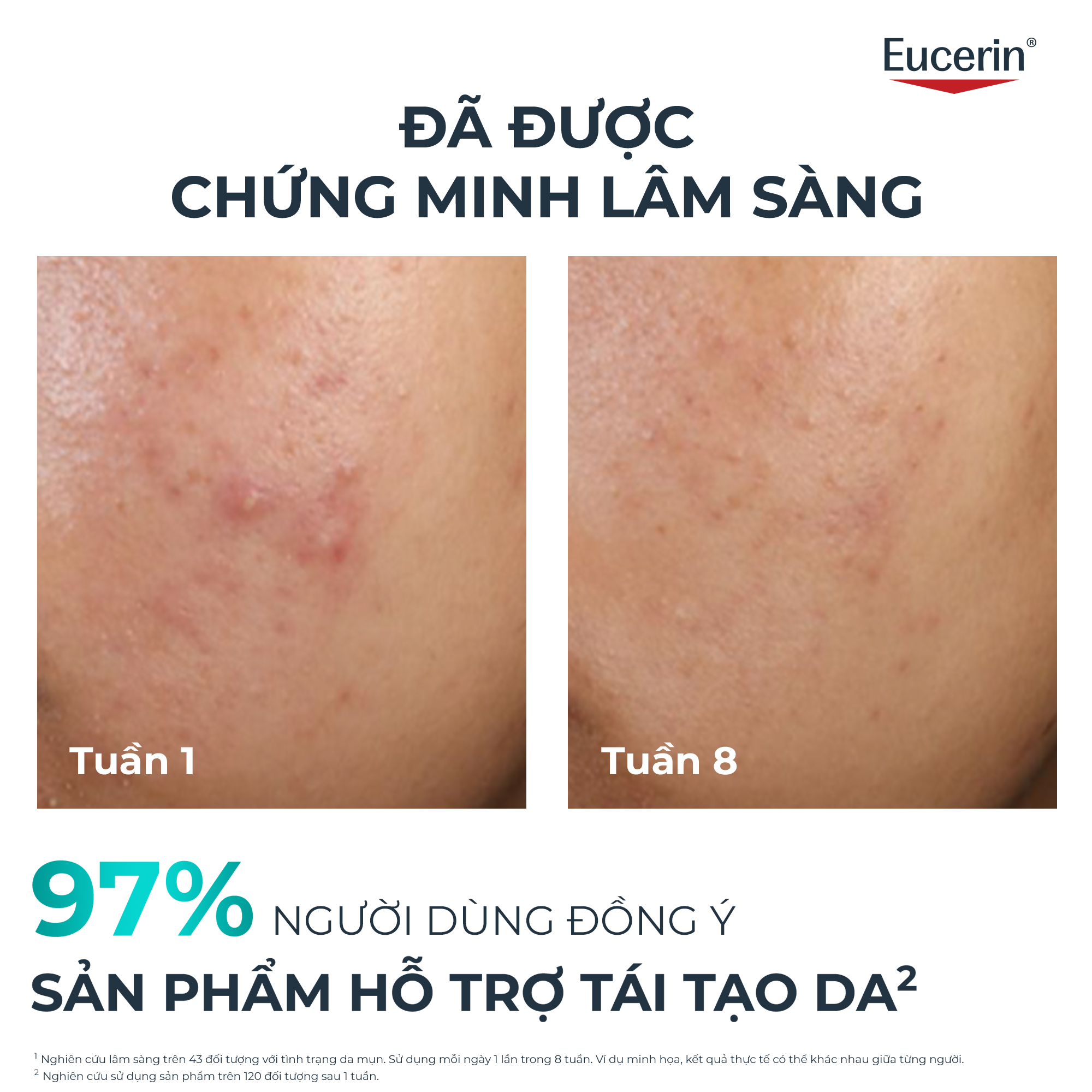Tinh chất giảm mụn và nhờn Eucerin® DermoPure Clinical Peeling 10 40ml | BigBuy360 - bigbuy360.vn