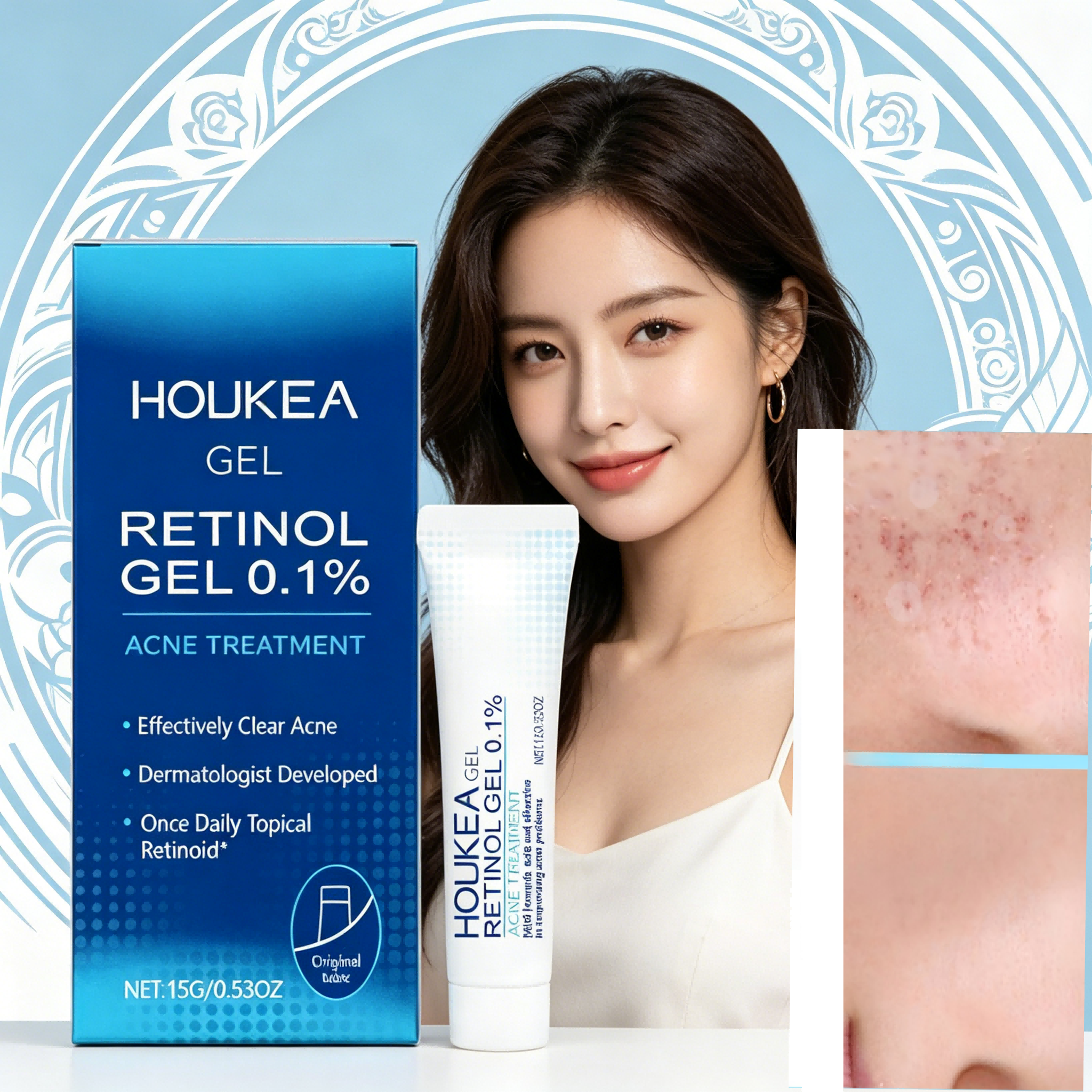 Mụn trứng cá, Gel 0,1% Retinol HOUKEA, Gel trị mụn chuyên nghiệp, Gel chăm sóc da loại bỏ vết thâm 1