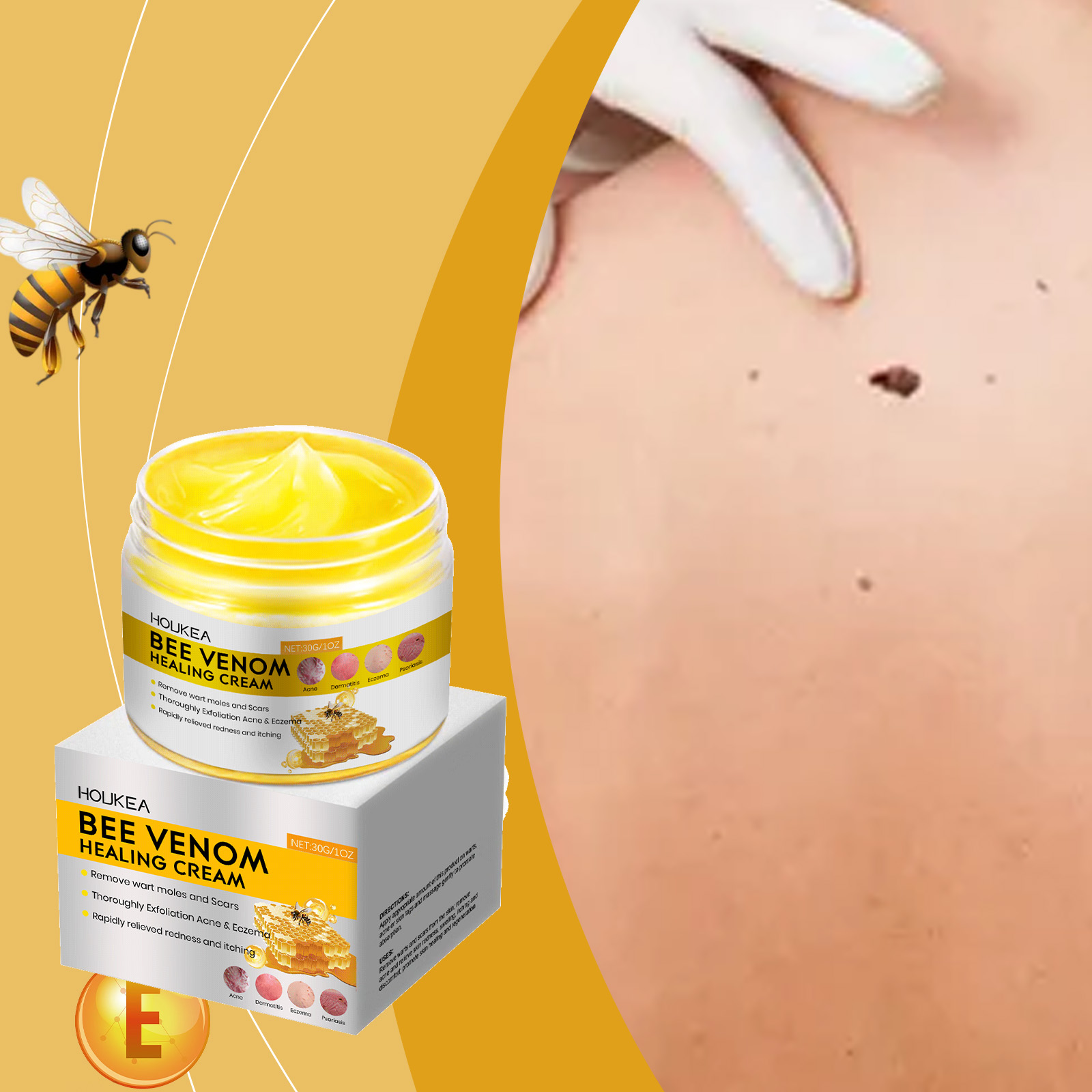 Kem liệu da bằng nọc ong, kem liệu da bằng nọc ong 2025, kem liệu da tự nhiên từ nọc ong, phù hợp vớ