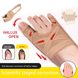  Nẹp chỉnh ngón chân vẹo, dụng cụ chỉnh hình cho ngón chân, 1 đôi vớ thoáng khí giúp giảm bunion và điều chỉnh ngón chân.