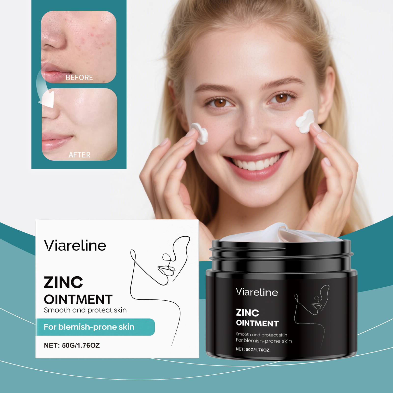 Kem mụn Salicylic Acid & Kẽm Oxide 50g với Tràm Trà & Oải Hương – Giảm Mụn cho Mặt & Cơ Thể