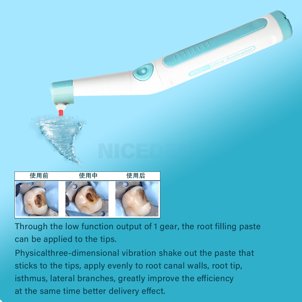 Dụng Cụ Kích Hoạt Rễ Nha Khoa Bằng Sóng Siêu Âm 3D Làm Sạch Hiệu Quả