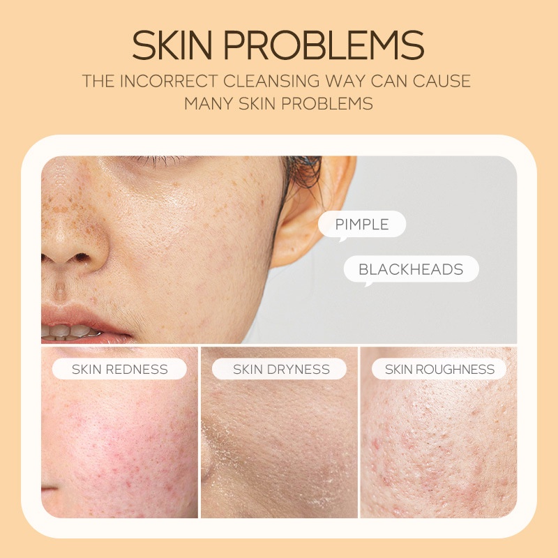 Sữa Rửa Mặt LAIKOU Vitamin C 120ml Làm Sạch Sâu Lỗ Chân Lông