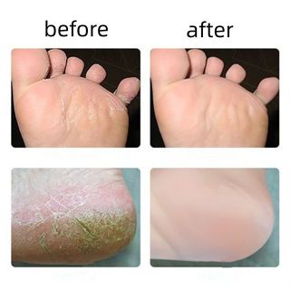 Cây chà gót chân Cọ Chà Gót Chân 2 Mặt bàn chà gót