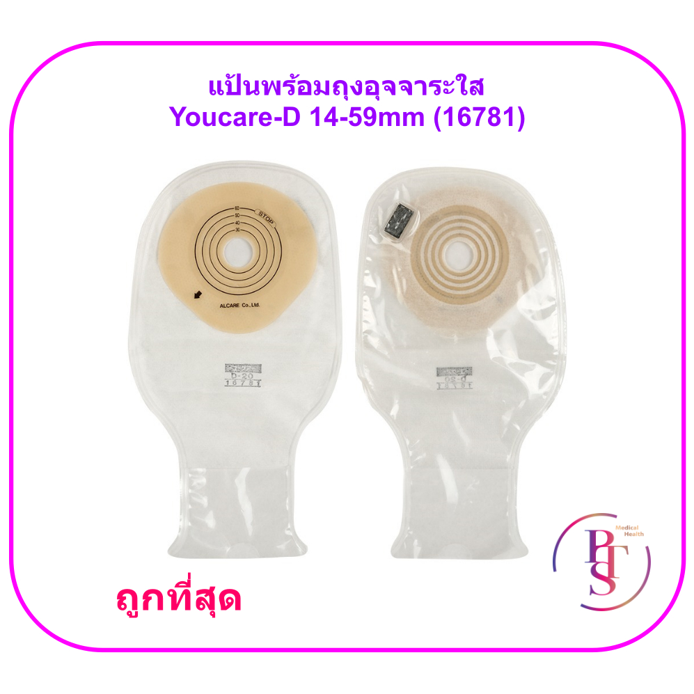 Tấm lót phân trong suốt Youcare-D 14-59mm (Alcare) (16781) (1 Cái)