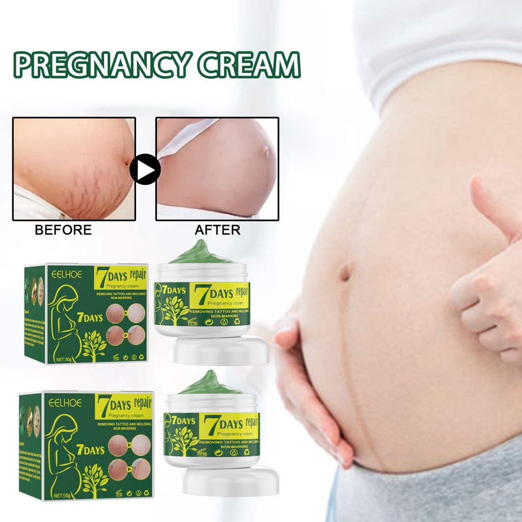 (mua 2 nhận được 1)Kem chống rạn da cho EELHOE 30g , thích hợp cho phụ nữ mang Thai, sửa chữa làn da béo phì và dưỡng da，chống rạn bụng đùi mông ngực cho bà bầu trước sinh sau sinh chống chảy xệ săn chắc