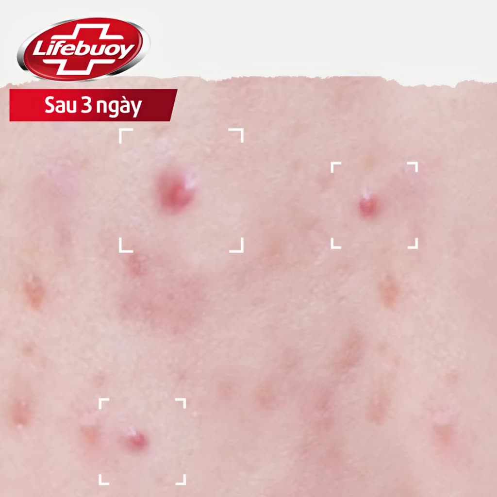 Sữa tắm Lifebuoy Thiên nhiên Detox Và Chăm Sóc Chuyên Sâu 800g | BigBuy360 - bigbuy360.vn