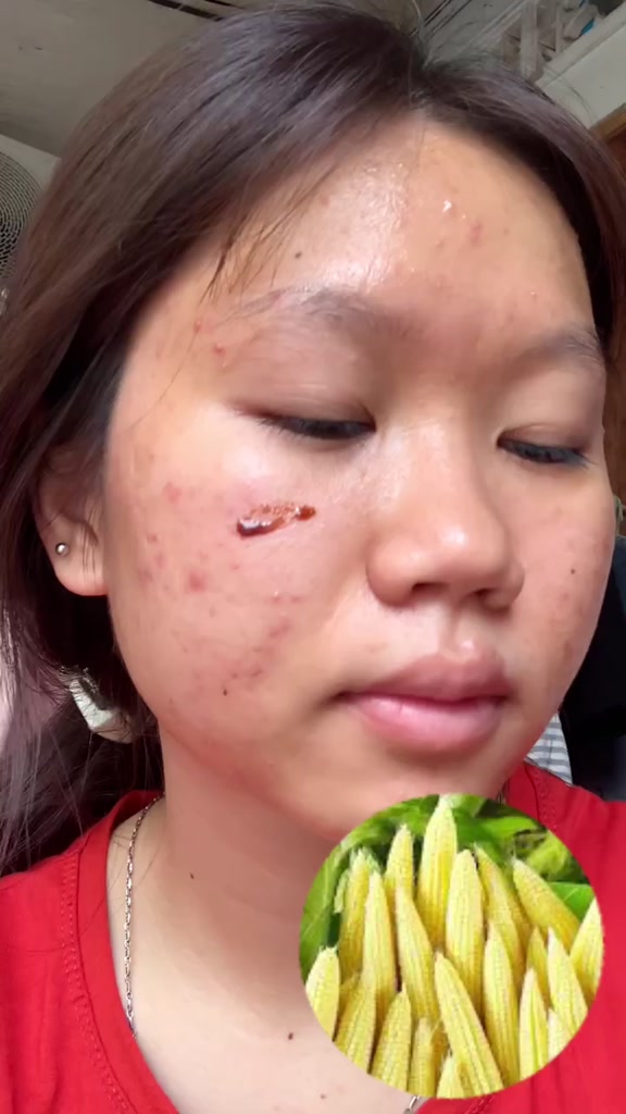 Serum Mụn Diếp Cá IGREEN 5ml - Giảm mụn, giảm thâm, se khít lỗ chân lông, dưỡng da | BigBuy360 - bigbuy360.vn