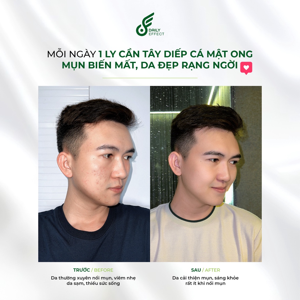 Nước Uống Giảm Mụn DAILY EFFECT (Đẹp Da - Mát Gan - Thanh Lọc Cơ Thể) | BigBuy360 - bigbuy360.vn