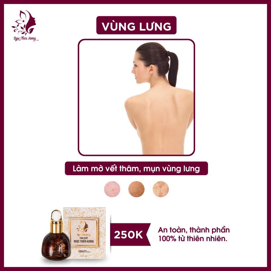 Serum xóa Thâm Nách, Thâm Mông, Đầu Gối, Khuỷu Tay Ngọc Thiên Hương, Chính Hãng (Che tên) | BigBuy360 - bigbuy360.vn