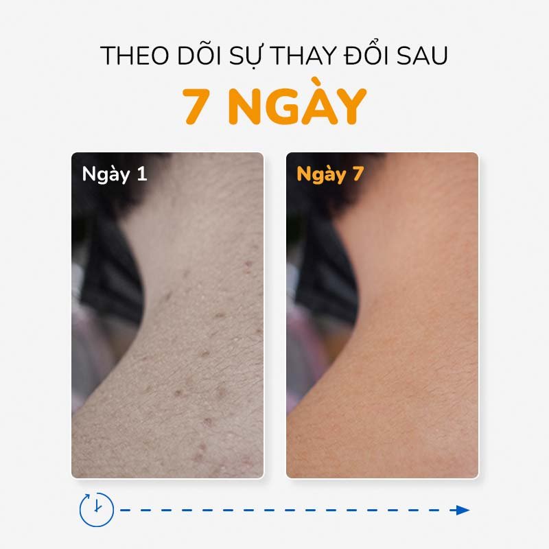 Xà Phòng Nghệ Giảm Mụn Lưng, Thâm Mông, Trắng Da NEOSKIN 75gr