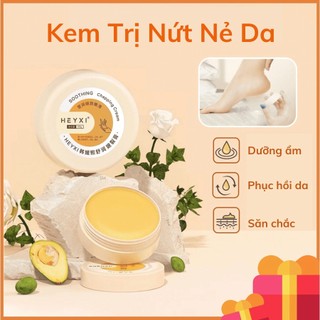 Kem chống nẻ kem dưỡng ẩm chống nứt nẻ da heyxi 20g