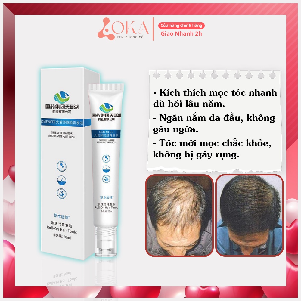 Serum kích mọc tóc cao cấp Omenfee cải thiện hói đầu nhanh chóng, giảm ngứa ngăn nấm tóc