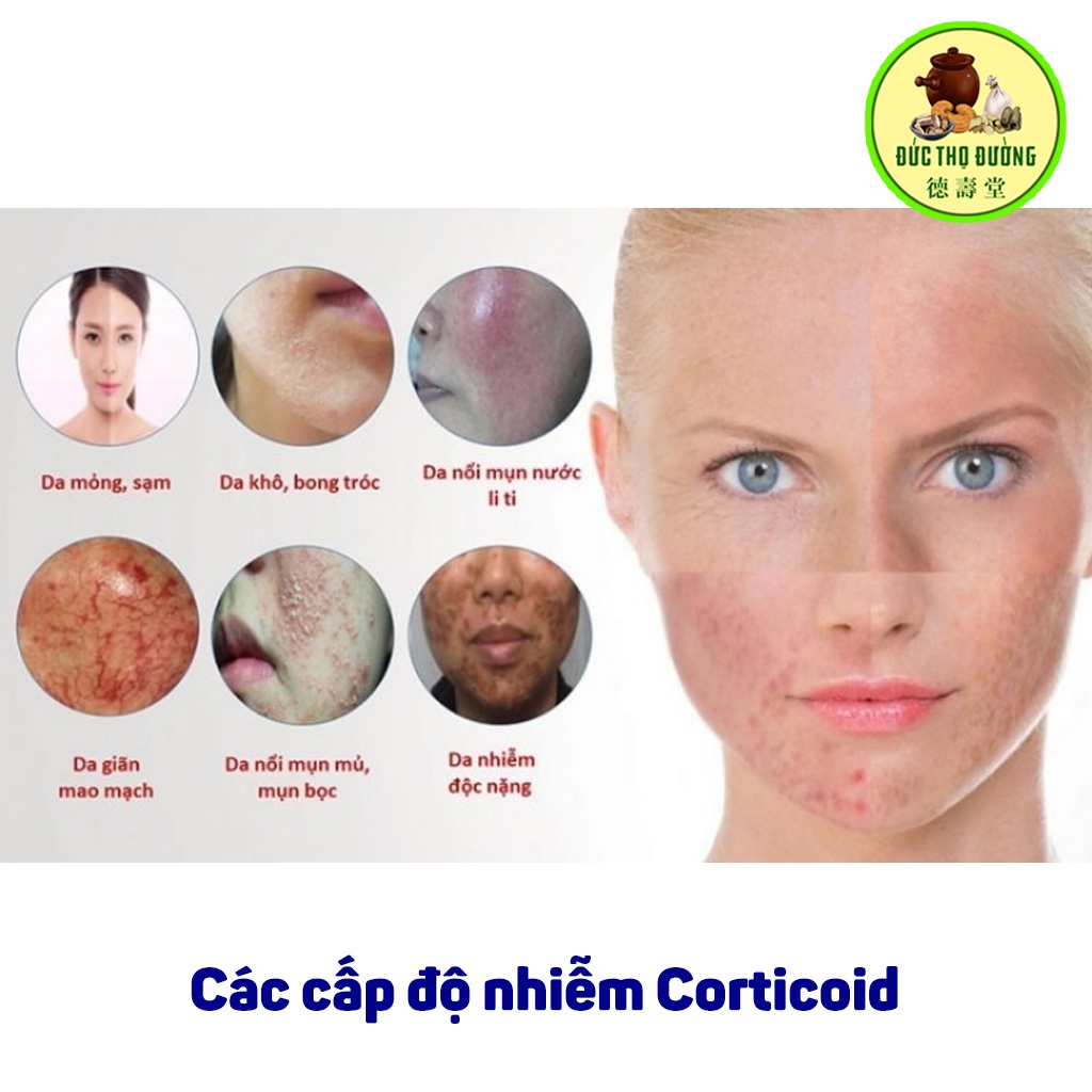 Combo Phục hồi da Đông Y - Dành cho da nhiễm corticoid