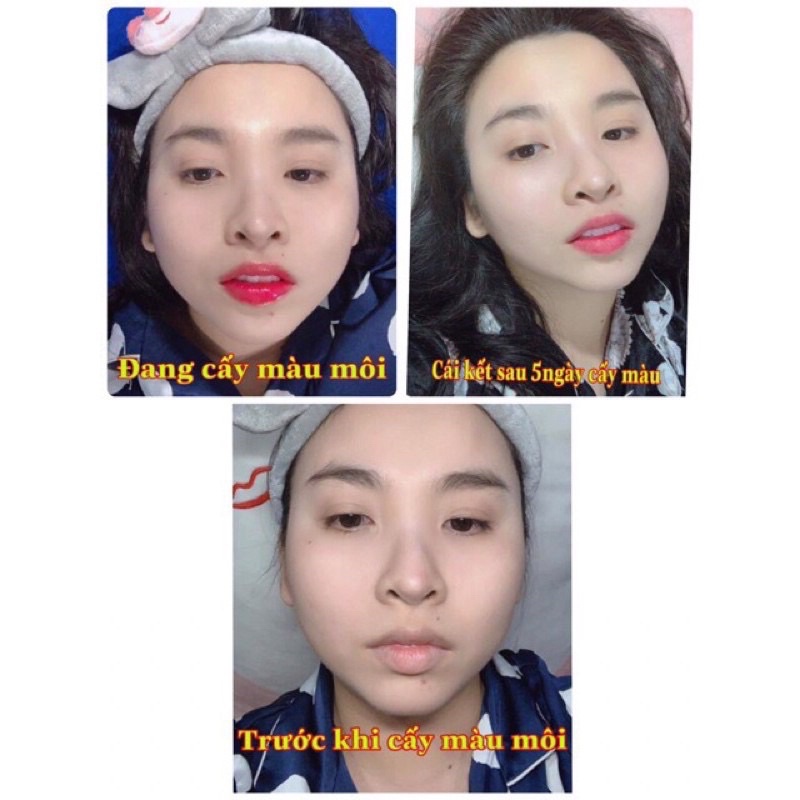 Combo Dưỡng Cấy Màu Môi Tế Bào Gốc ThiênDi Tẩy Thâm Môi Cấy Hồng Môi Tự Nhiên Kích Màu Phun Xăm 2023
