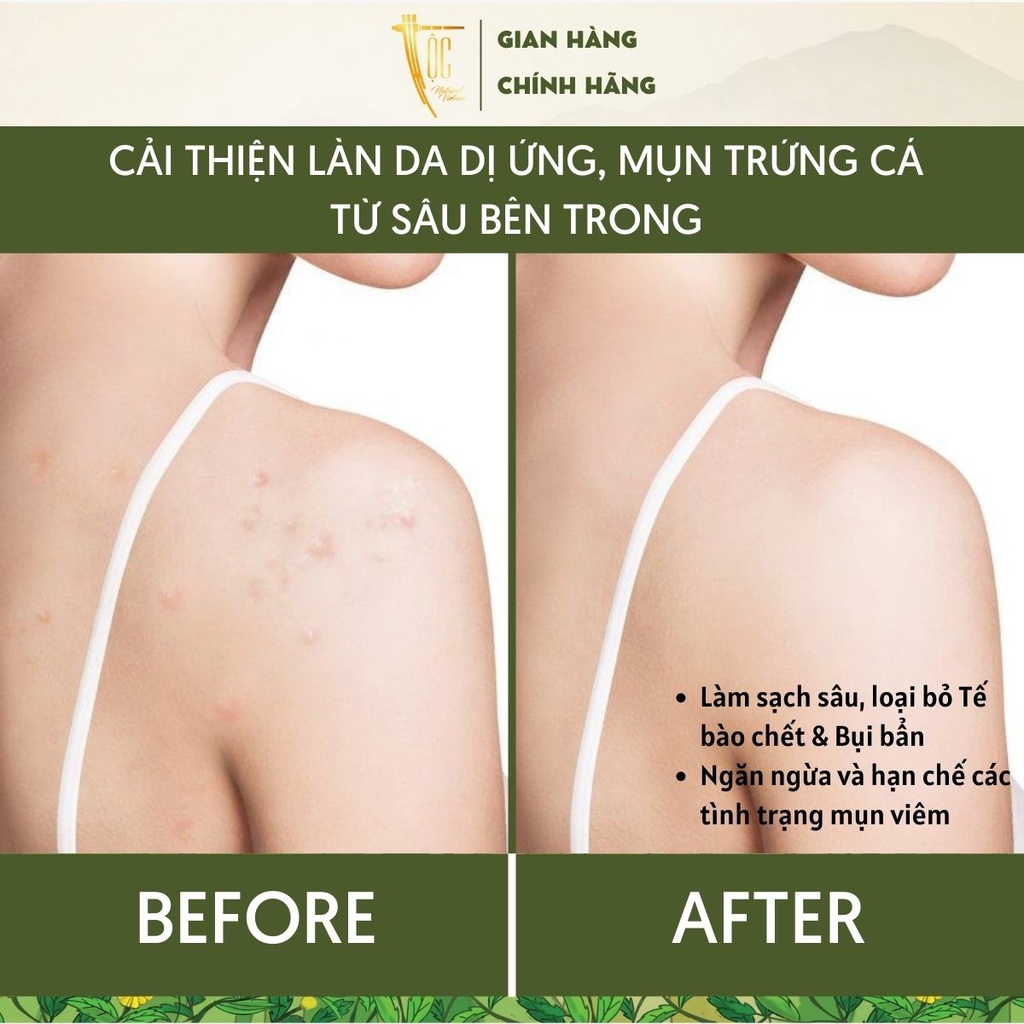 Combo Sữa tắm 300ml & Serum 10ml Mướp đắng rừng & Tràm trà Cao Bằng TỘC Natural sạch khuẩn, giảm mụn và viêm nang lông
