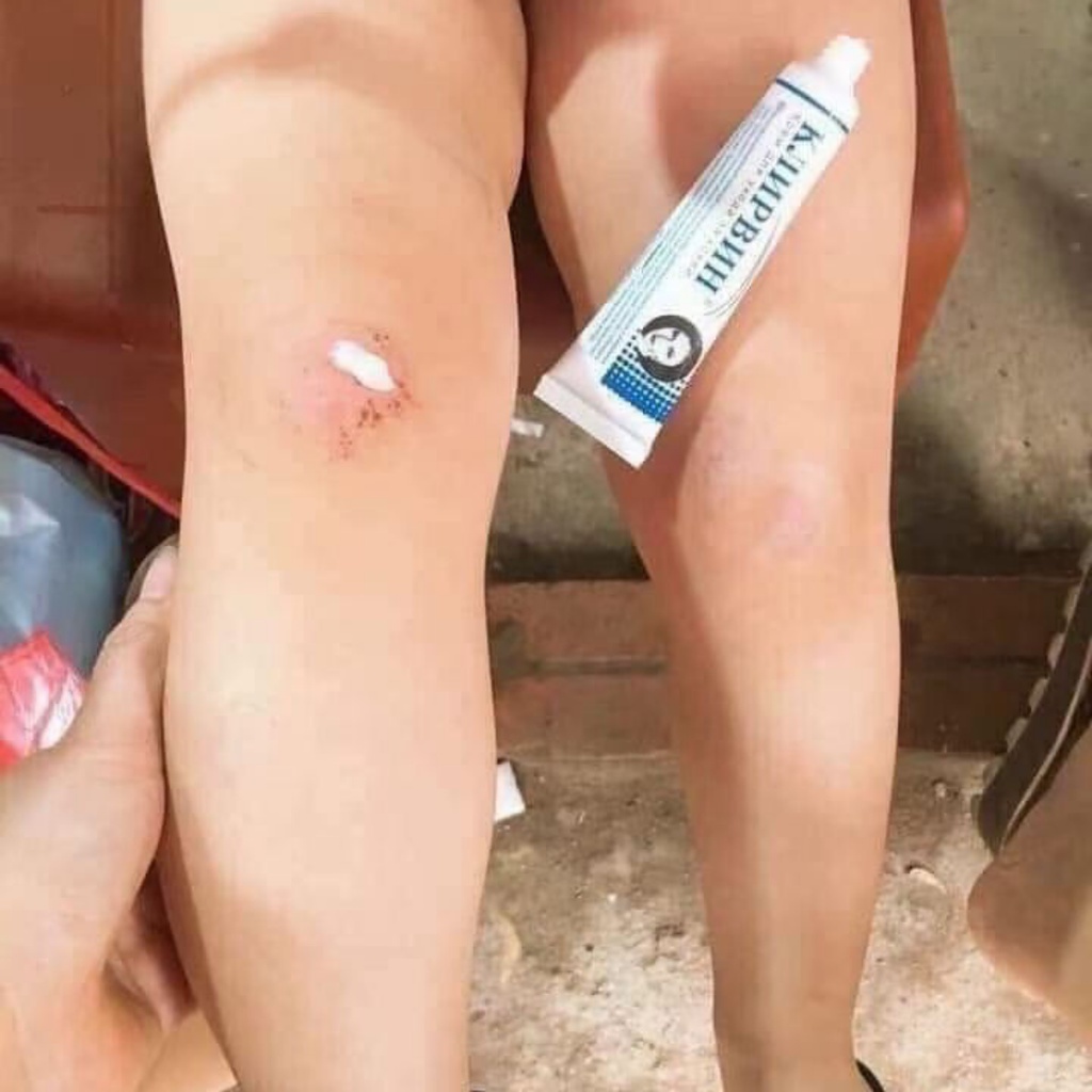Kem Sẹo Nga Klirvin Mờ Sẹo Lồi, Sẹo Lõm, Làm Mờ Vết Sẹo Thâm Cải Thiện Vùng Da Tối Màu 25gr - Besty Beauty