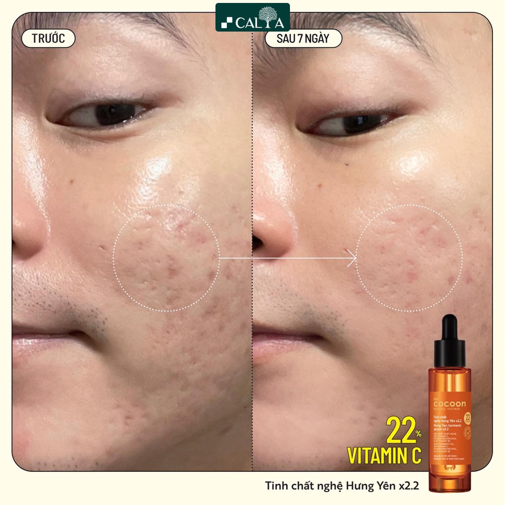 Tinh Chất Serum Cocoon Nghệ Hưng Yên x2.2 Với 22% Vitamin C Làm Sáng Da Chuyên Sâu, Mờ Vết Thâm, Thuần Chay 30ml