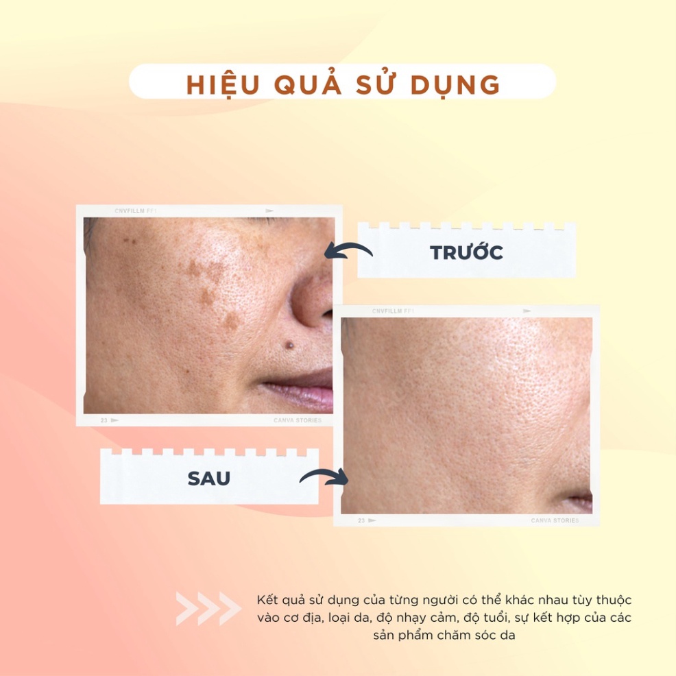 Kem dưỡng trắng da collagen Chamis - ngừa nám, phục hồi độ mịn và mềm mại cho da