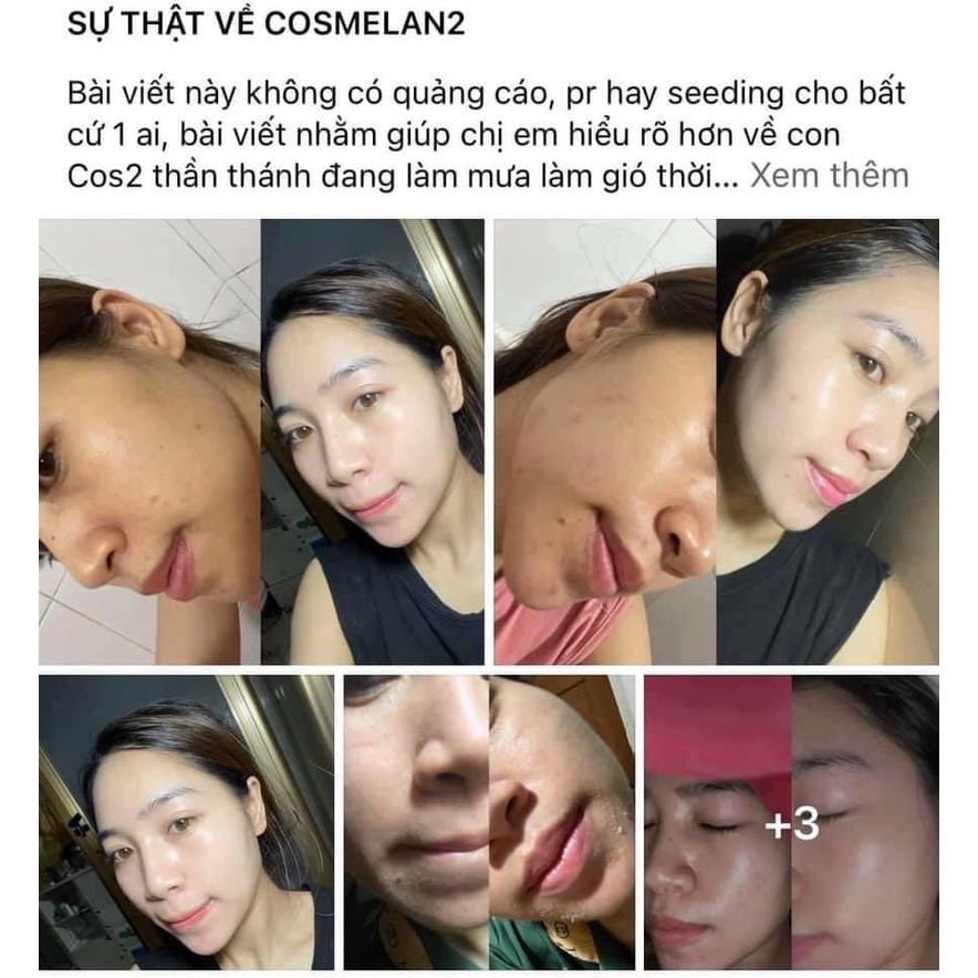 Cosmelan 2,Kem giúp giảm nám Mesoestetic Cosmelan2